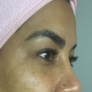 Limpieza facial premium Cali