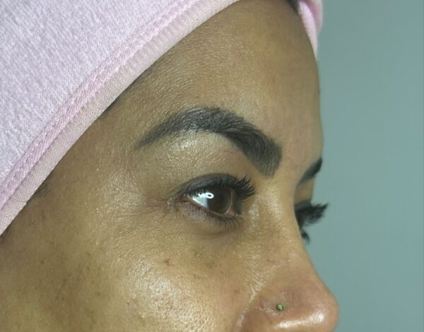 Limpieza facial premium Cali