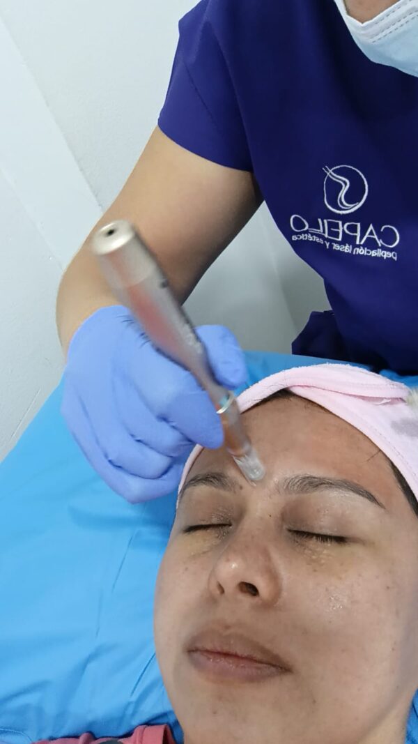 Capello Glow Plasma y Limpieza Facial