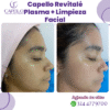 Capello Revitalé Plasma facial